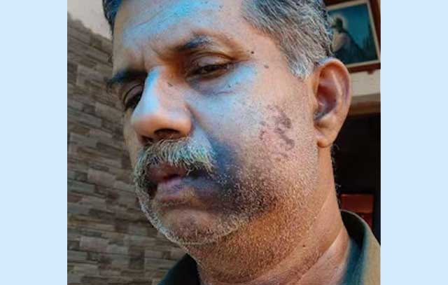 স্কুলের ‘রিইউনিয়নে’ আক্রান্ত সেই সহপাঠী ভি জে বাবু। ছবি: সংগৃহীত