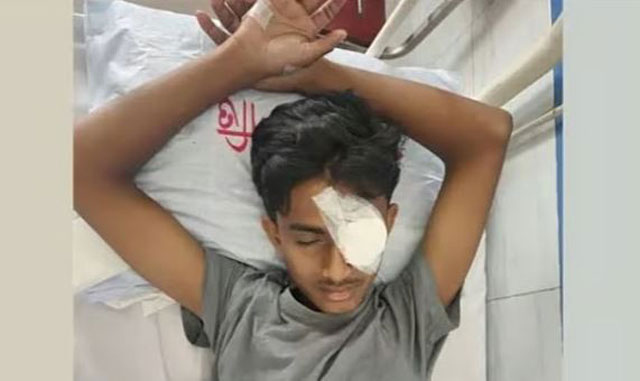 হবিগঞ্জে এনসিপির কর্মসূচিতে ছাত্রদলের হামলায় গুরুতর আহত আলিফ। ছবি: সংগৃহীত